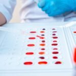 CRIB ब्लड ग्रुप: भारत में मिला दुनिया का सबसे अनोखा रक्त प्रकार